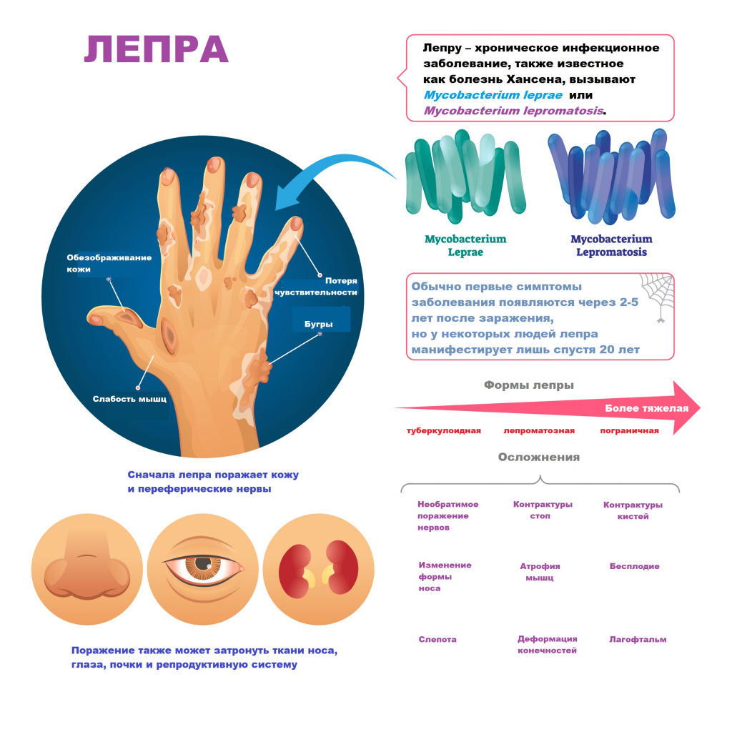 ЛЕПРА (ПРОКАЗА).